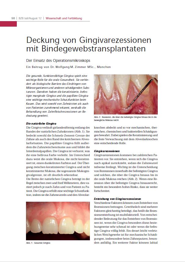 Der Münchner Parodontologe Dr. Wolfgang M. Zimmer setzt das Operationsmikroskop zur Deckung von Gingivarezessionen mit Bindegewebstranplantaten ein.