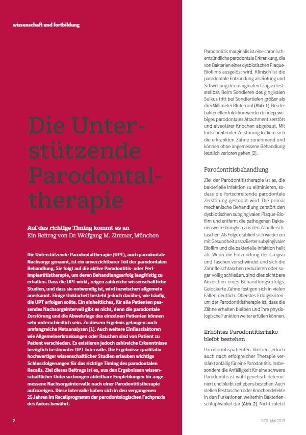 Die parodontale Nachsorge ist ein wichtiger Teil der Parodontitisbehandlung. Für den langfristigen Behandlungserfolg kommt es auf das richtige Timing an.